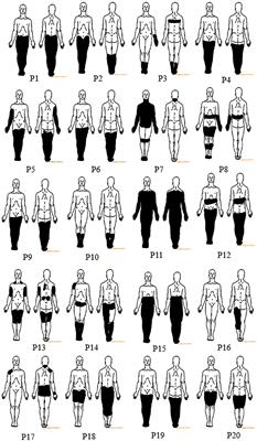 EEG Correlates of Self-Managed Neurofeedback Treatment of Central Neuropathic Pain in Chronic Spinal Cord Injury